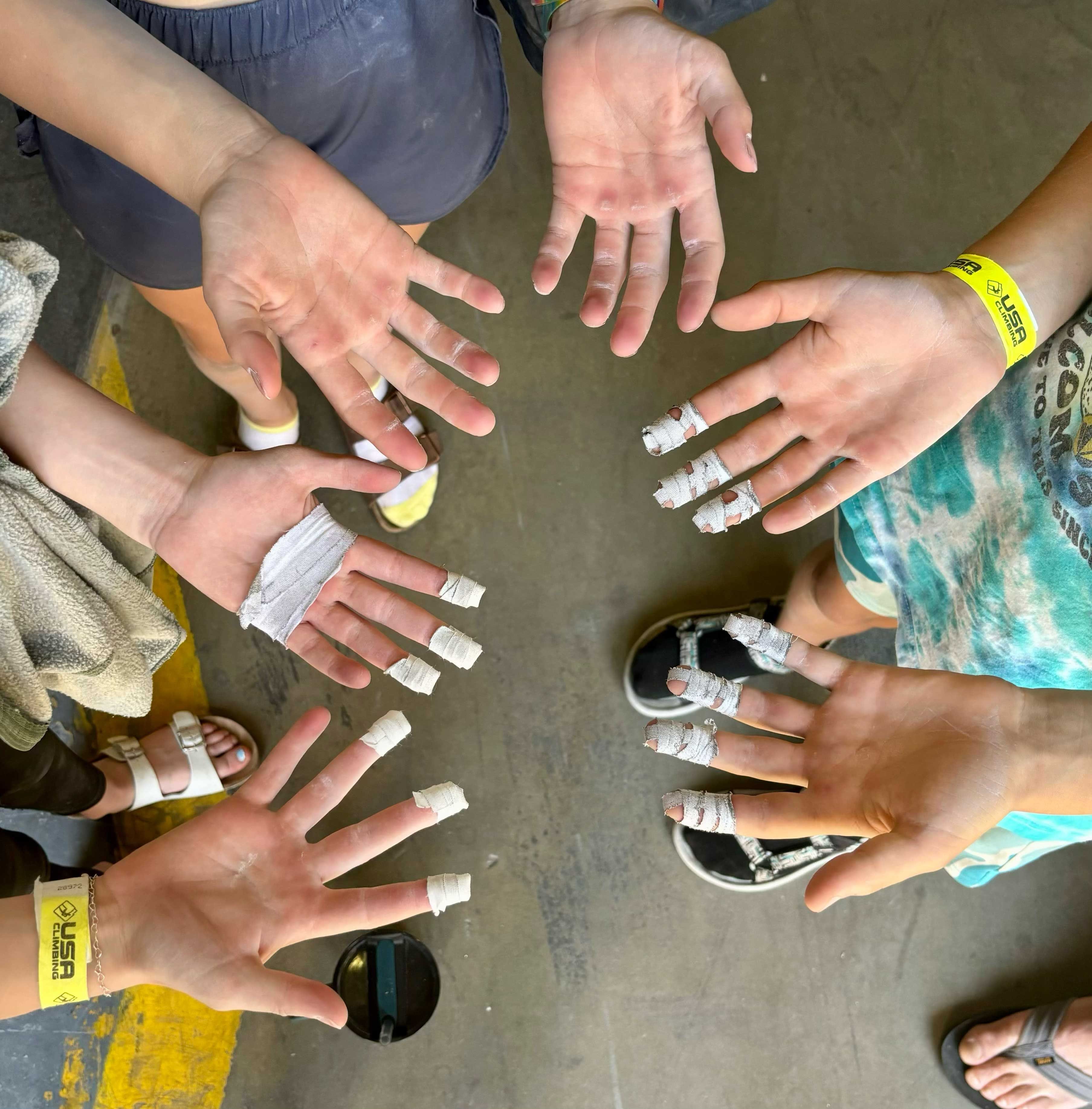 Youth climbers show their worn fingers